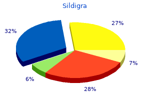 sildigra 50mg on-line